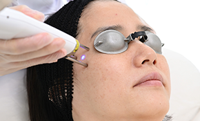 ピコセカンドレーザーピコフラクショナル