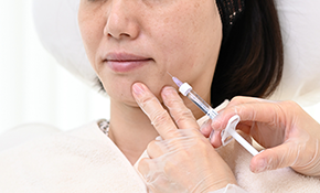 注入治療(ヒアルロン酸、ボツリヌストキシン)